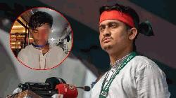 আলিফের চোখের দৃষ্টি টোটালি শেষ, চিকিৎসকের বরাতে সার্জিস